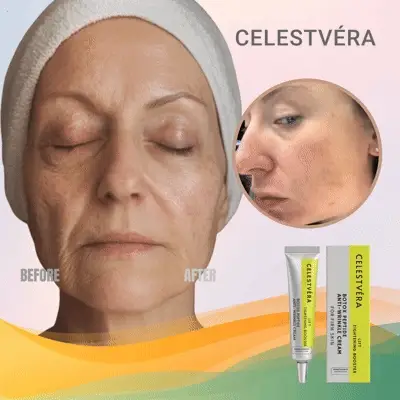 Get Botox-Level Tightening Without the Needle, Stroke Face, or 800 Maintenance!